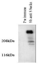 Western blotting total cellular protein from cultured rat aortic smooth muscle cells was prepared and analyze. The protein was transferred to a PVDF membrane, blocked 1XTBS, 0.1% tween 20/ 5%NFDM, probed with 5 µg/ml of pre-immune serum 5 ug of S125P antibody (a 3 second exposure is shown). The blot was then washed and probed with monoclonal anti-sheep IgG coupled to HRP 1:10,000, and detected with luminol.